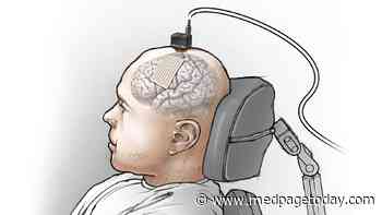 Brain Implant Translates Neural Signals Into Sentences