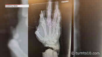 Rhode Island surgeon says 'this is one of the worst injuries I've seen in my career' - WJAR