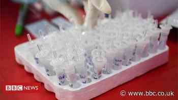 Coronavirus: Robin Swann concerned by rise in Covid-19 cases - BBC News