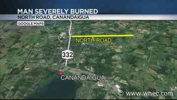 Canandaigua man dies from injuries after being flown to hospital with burns