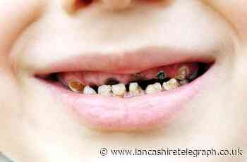 Blackburn with Darwen tops the child tooth decay table again - Lancashire Telegraph