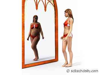 Hospitalizations for Eating Disorders Increased Significantly Among Adolescents During COVID Pandemic