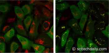 Parkinson’s, Cancer, and Type 2 Diabetes Share a Key Element That Drives Disease