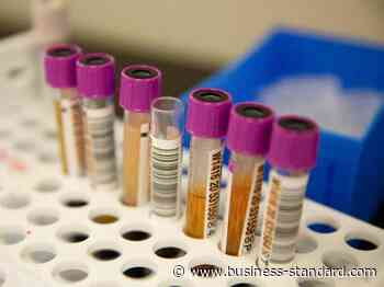 Karnataka reports 1,869 fresh coronavirus cases, 42 deaths in past 24 hours - Business Standard