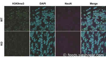 Researchers discover a key link to autism spectrum disorders