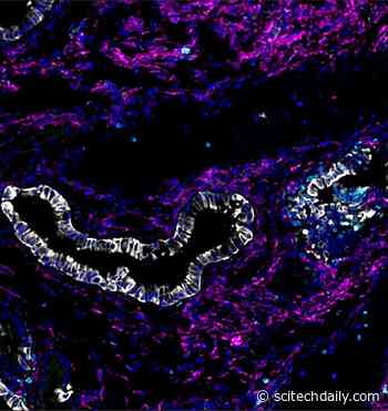 Why Identical Genetic Mutations Cause Different Types of Cancer