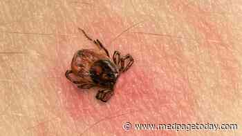 Why Are Tick-Borne Illnesses Increasing in the U.S.?