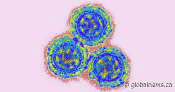 Active COVID-19 infections lowest this year with 10 in Saskatchewan ICUs