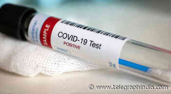Novel coronavirus, related to SARS-Cov-2, in UK horseshoe bats: Research - Telegraph India