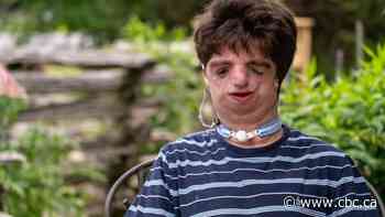 'I may look different, but inside I'm a lot like you'