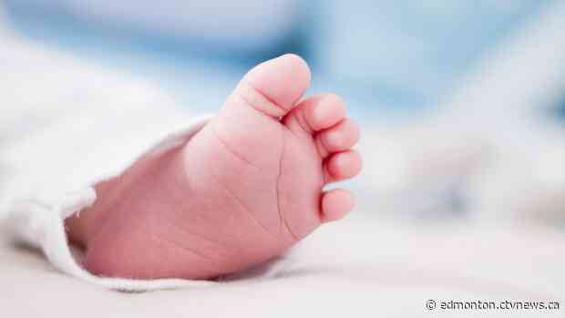 Alberta to start screening newborns for spinal muscular atrophy