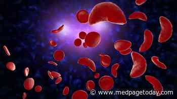Sickle Cell Disease Tied to COVID-19 Mortality, Hospitalizations