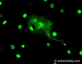 New Research Reveals Immune Cell’s Response to Pathogens Differs Greatly by Sex and Age
