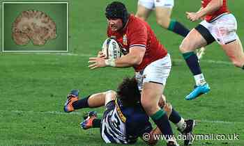 23% of elite rugby players have brain structure abnormalities, study finds