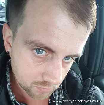 Derbyshire gardener awarded £7,000 compensation after dentist 'failed' to treat tooth decay - Derbyshire Times