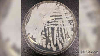Untreatable 'superbug' fungus has spread in 2 US cities, health officials say