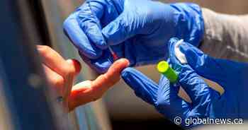 Should you get an antibody test after COVID-19 vaccine? Doctors say it’s complicated