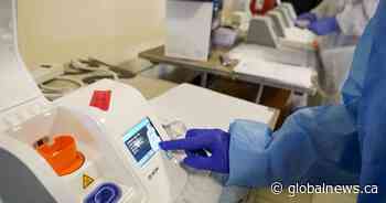 Number of active COVID-19 cases in Alberta rises by 123 on Friday