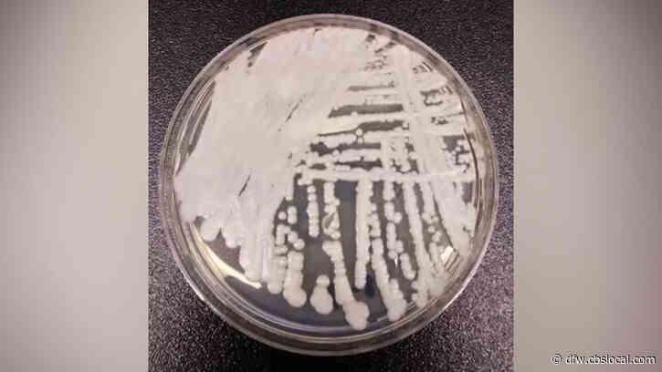 Collin County Says Candida Auris Fungus Responsible For 4 Deaths