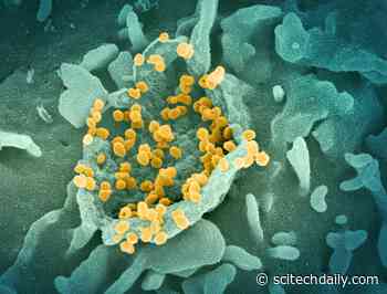 Early Antiviral Response in the Nose May Determine Mild / Severe Course of COVID-19