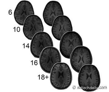 Neurotransmitter Levels in the Brain Predict Math Ability