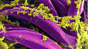 Colorado 10-year-old dies as health officials investigate plague activity