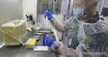 Alberta’s number of active COVID-19 cases rises by 284 over weekend, R-value at 1.48