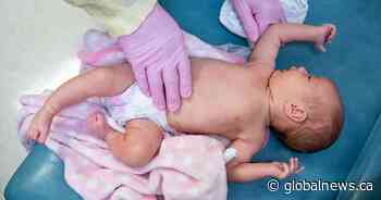 Canada could see resurgence of potentially deadly childhood respiratory virus this summer: report