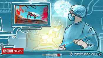 The new surgical tool inspired by a wasp