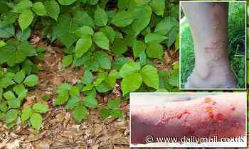 Climate change is making poison ivy itchier and could make it grow 150 percent faster 