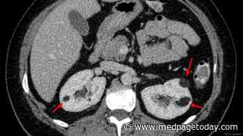 More Data Support Active Surveillance for Small Renal Masses