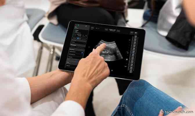 Exo secures $200M toward commercializing ultrasound device