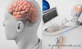 New York company gets jump on Elon Musk's Neuralink with brain-computer interface in clinical trials