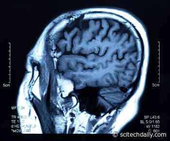 Study Shows “Harsh Parenting” May Lead to Smaller Brains