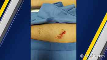 15-year-old bitten by what is believed to be a shark at Wrightsville Beach