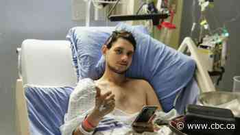 Leduc man's leg amputated after being shot in carjacking