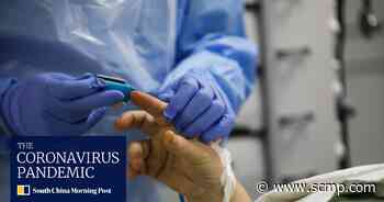 Britain warns coronavirus monitor devices work less well for darker-skinned people - South China Morning Post