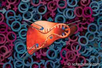 RNA Modification May Protect Against Fatty Liver Disease