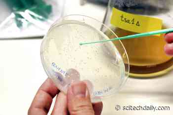 Research Shows Cell Aging Can Be Slowed by Oxidants