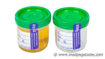 Urine Tests Before Surgery Blasted as Mostly Unnecessary