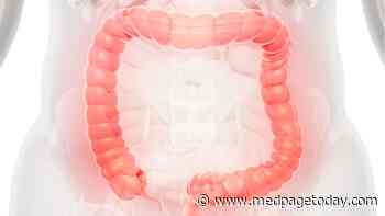 Two Ulcerative Colitis Biologics: Same Clinical Difference?