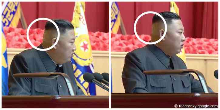 Kim Jong Un was pictured with a strange green mark and a band-aid on the back of his head, fueling further theories about his health