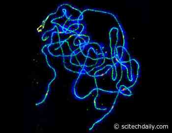 Century-Old Mysterious Puzzle Solved: How Sex Cells Get the Right Genetic Mix