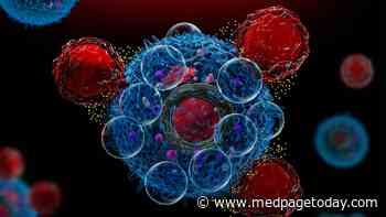 Anti-CD7 CAR-T Therapy Yields High Response Rate in Acute Leukemia