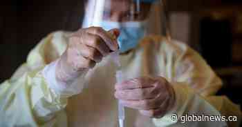 ICU, hospital numbers climb slightly as Alberta confirms 397 cases of COVID-19 Thursday