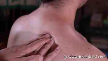 South Florida Massage Therapist Arrested for Alleged Sexual Assault