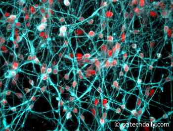 Gene Targets of Stress Hormones Identified in the Brain Could Lead to Prevention and Treatment of Mental Health Disorders