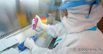 Alberta adds 369 new COVID-19 cases Friday