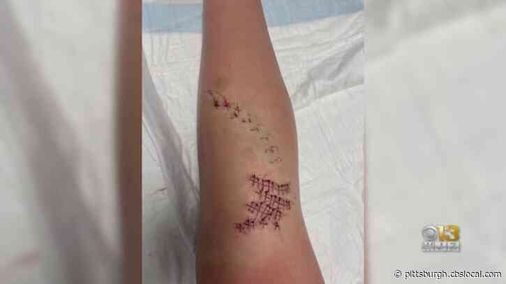 12-Year-Old Pennsylvania Girl’s Injuries Consistent With Shark Bite, A Maryland First