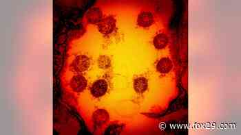 Cholesterol drug cuts coronavirus infection by 70%, researchers find - FOX 29 News Philadelphia
